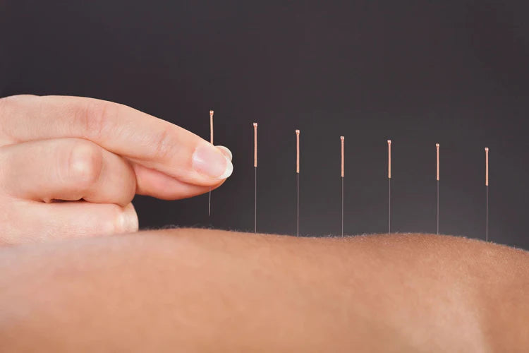 Massage Therapy and Acupuncture